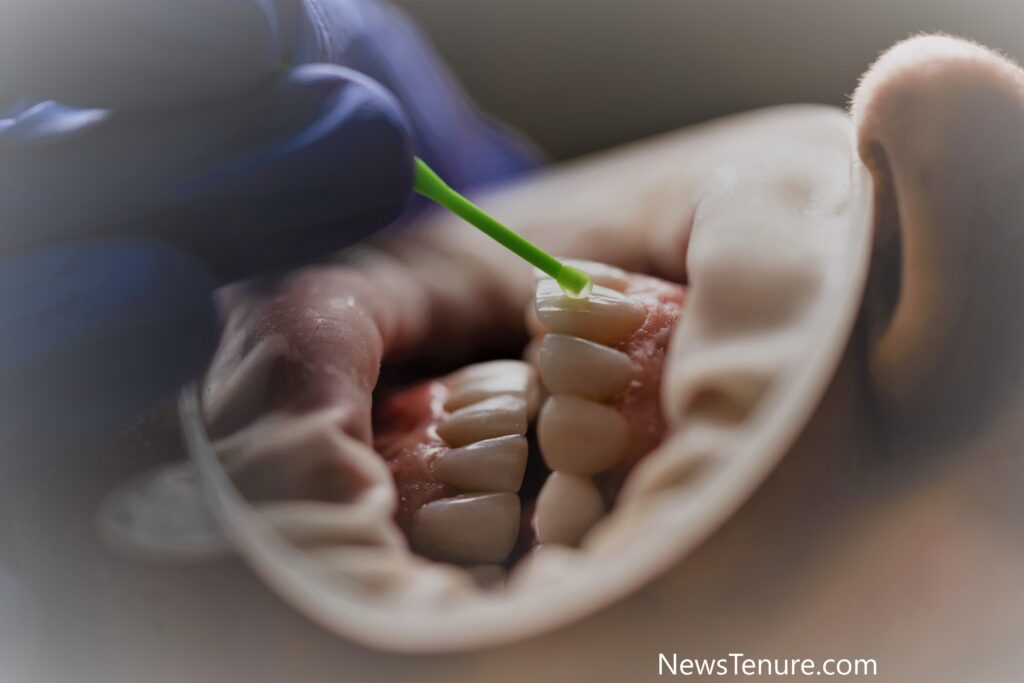 Lovnox Misaligned Teeth settlement process